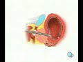 PreOp® Patient Education Cystoscopy Via Penis, Male Surgery