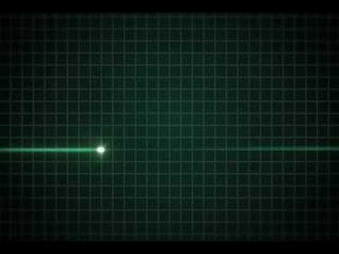 EKG flatline