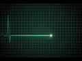 EKG flatline