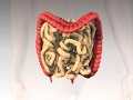 Home Colonic Irrigation Cleansing - Hemorroid Treatment
