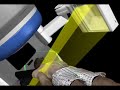 Image Guided Radiotherapy (IGRT) Trilogy  Radiation Therapy Radiotherapy