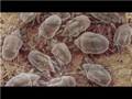 Allergy Symptoms & Treatments : How to Cure Dust Allergies