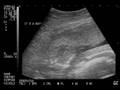videos de Our Sonogram