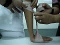 PN SKILLS 2 - Bandaging ( Dorsiflexion Assist )