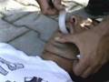 inserimento cannula orofaringea