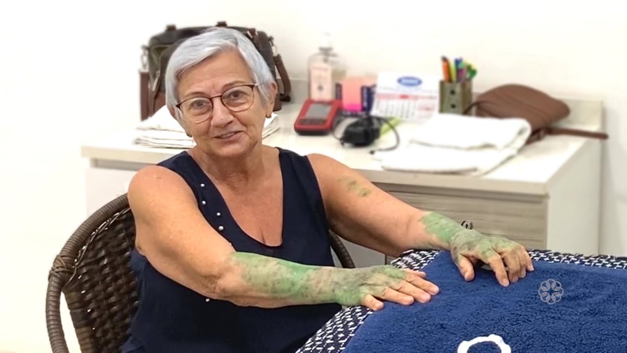 D. Cida - Cliente de Americana SP - Cima's Estética