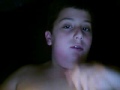 my surgery