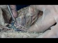 Cat Arteries N Veins.mp4
