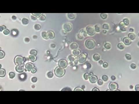 Yogurt Is Alive Bacteria Under Light Microscope Joshua Wilson