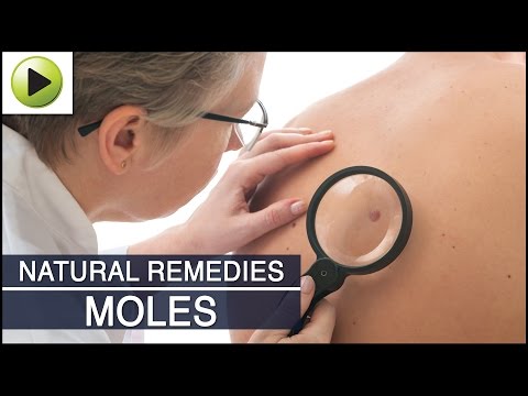 Skin Care - Moles - Natural Ayurvedic Home Remedies