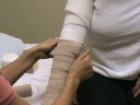 lymphedema wrapping for arm