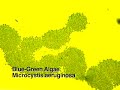 Klamath Dams: Toxic Algae