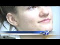 Laser Facial Resurfacing