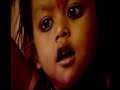 8 limbed baby to have an operation full story on TV