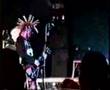 casualties-live-ugly