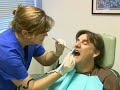 Dental Treatments: Coronal Teeth Polishing : Coronal Teeth Polishing: Tooth Coverage