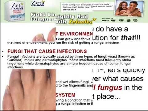 how to get rid of vomit fungus