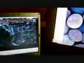 1 LAPTOP 2 SCREENS