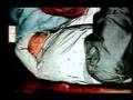 Baader Meinhof Intro