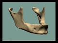 Lower Jaw Bone Loss