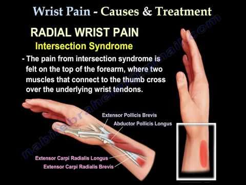 how to treat tendonitis in wrist