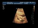 baby-cathey-12-weeks-part-2.html
