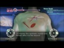 Atlus USA Teaser Trailer: Trauma Center: New Blood Atlus USA Teaser Trailer: Trauma Center: New Blood