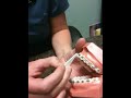 Class one elastics
