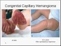 Medical School Pathology, Chapter 10j