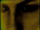 Amygdala Music Video(Frost Atom heart) Amygdala Music Video(Frost Atom heart)
