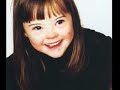 Downs syndrome - '365'