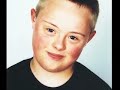 Down syndrome:&nbsp;Down Syndrome: 365 Shifting Perspectives Calendar