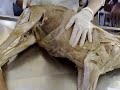aula francynny anatomia uberaba