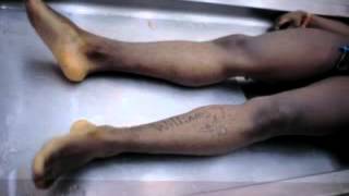 Billionaires Organ Harvesting. Sacrifice The Poor To Save The Rich -VIDEO-