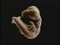 videos de Reverse Pregnacy MV SHOSTAKOVICH