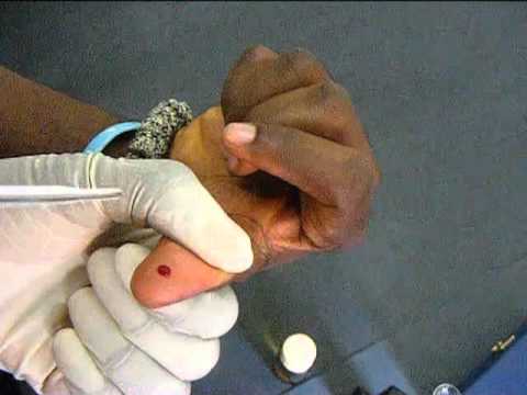 how to do test estimation