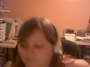 me showing off my hand it looks bad