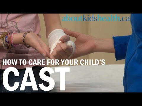 how to properly elevate a broken ankle