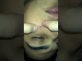 Big O zit