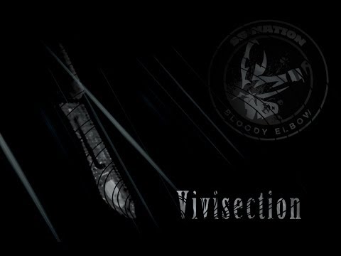 MMA Vivisection: UFC Gustafsson vs Manuwa, Bellator 111 predictions