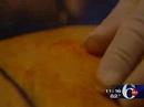 WPVI Channel 6 - SmartLipo at Physician Body Solutions WPVI Channel 6 - SmartLipo at Physician Body Solutions