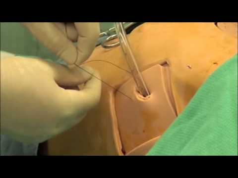 how to drain chest tube