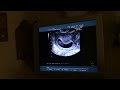 ultrasound1,,