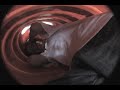 Thumbnail #1