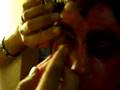 what causes excessive protein deposits on contact lenses