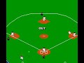 the two errors in the first inning were interesting, but they kept on piling up as the game went on, including a passed ball to the catcher, and overthrow at 1st base, and my short stop getting nailed in the forehead. then i make the premonition that 