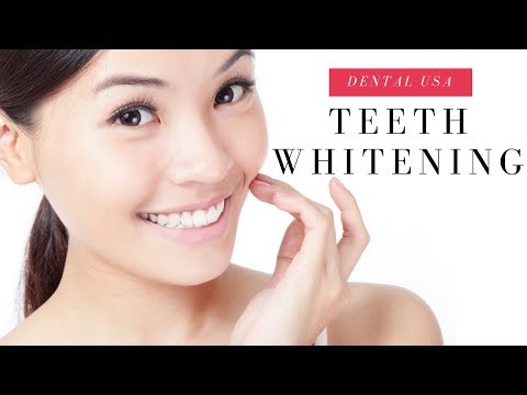 how to whiten with baking soda