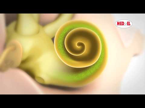 hören - Dieses Video erklärt die Ursachen von Hörverlust und Hörschwächen und gibt Einblicke in den Prozess des Hörens. Cochlear Implantate können Kindern und Erwach...