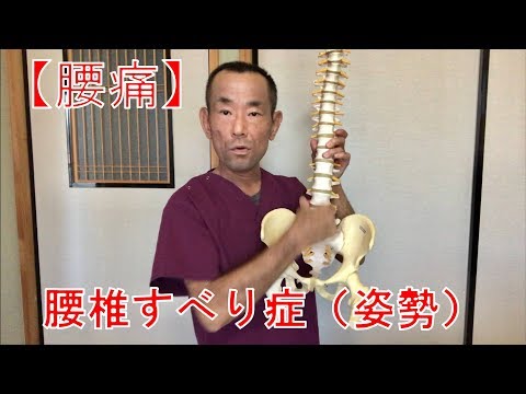 【腰痛】腰椎すべり症（姿勢）①