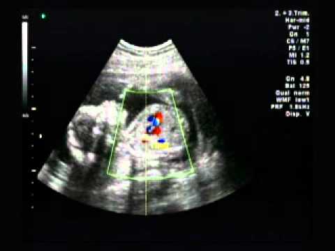 Ultrasound Gel – Baby Scan